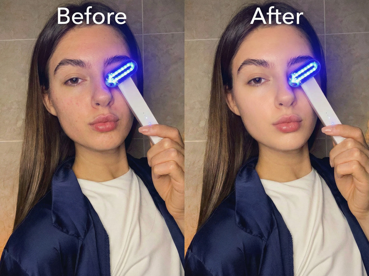 ZAQ ZAYN Before After