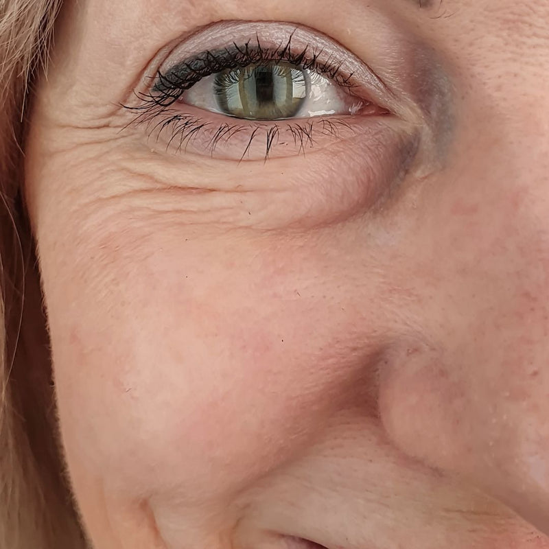Close-up of a person's eye with visible wrinkles and skin texture.